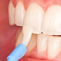 Глубокое фторирование: покрытие фторосодержащим гелем зубов