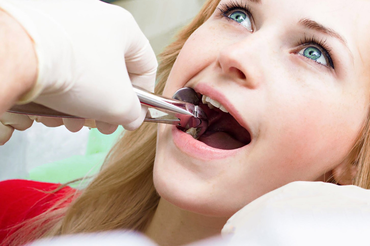процедура при сложном удалении зуба