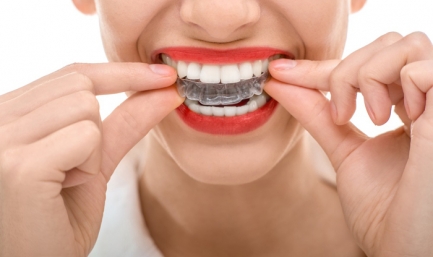 Системы отбеливания зубов в домашних условиях